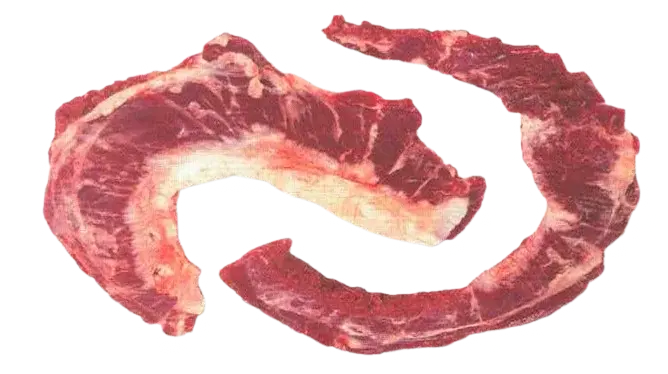 Diaframma